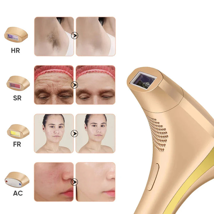 Unisex Laser Epilator for Hårfjerning Ansikt og Kropp