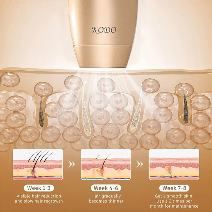 Unisex Laser Epilator for Hårfjerning Ansikt og Kropp